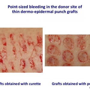 Point-sized bleeding