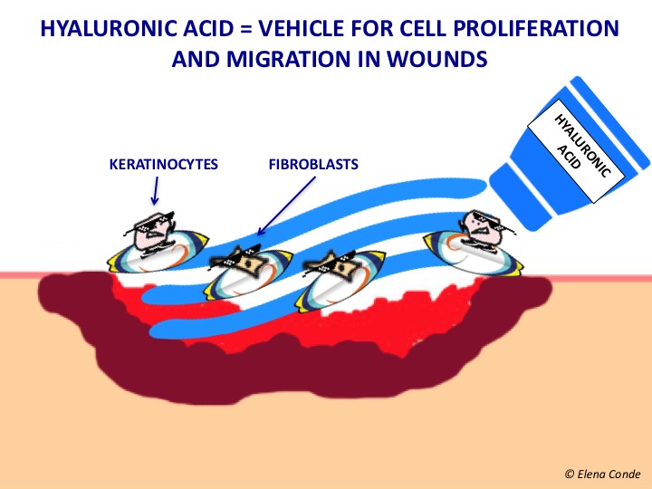 acid hialuronic migrate