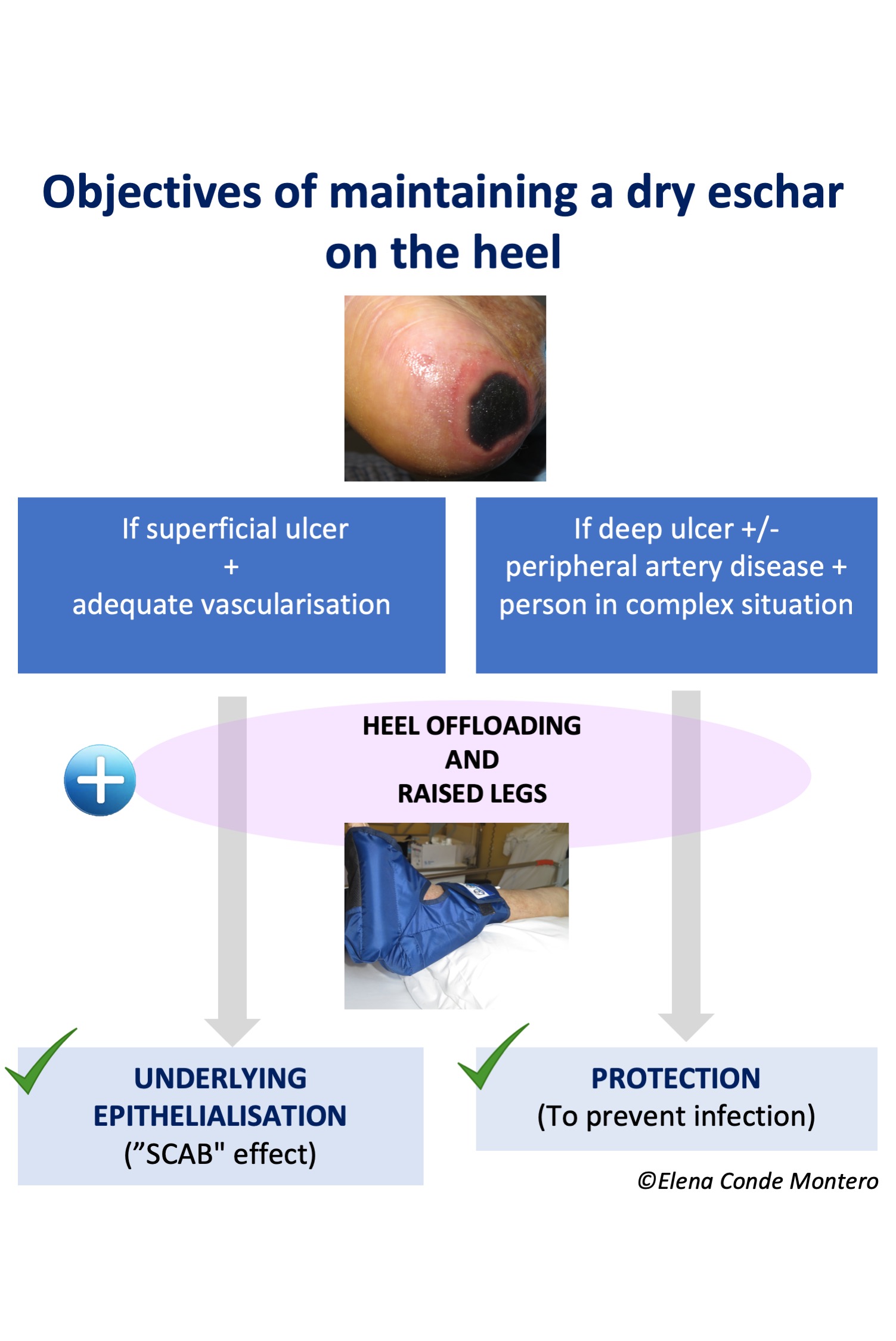 Ulcer Solutions | Pressure Injury Prevention & Treatment